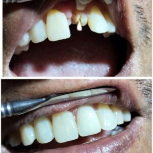 galeri (1) galeri (1)