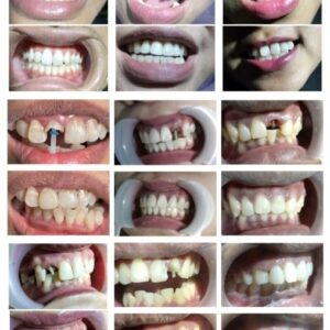 galeri (2) galeri (2)