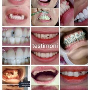 galeri (3) galeri (3)